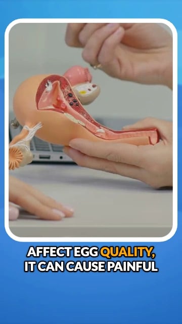 What are some of the Challenges of being a Fertility Doctor?
