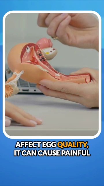 What are some of the Challenges of being a Fertility Doctor?